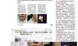 绵阳医美爆料事件最新情况,真相逐步浮出水面，行业监管再引关注